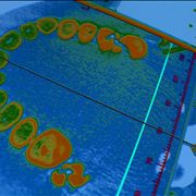 Picture Of Dental Diagnosis Scan