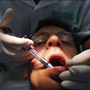 Picture Of Dental Injection