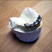 Picture Of Dental Mold In Progress