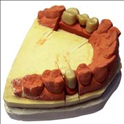 Picture Of Dental Mold With Path